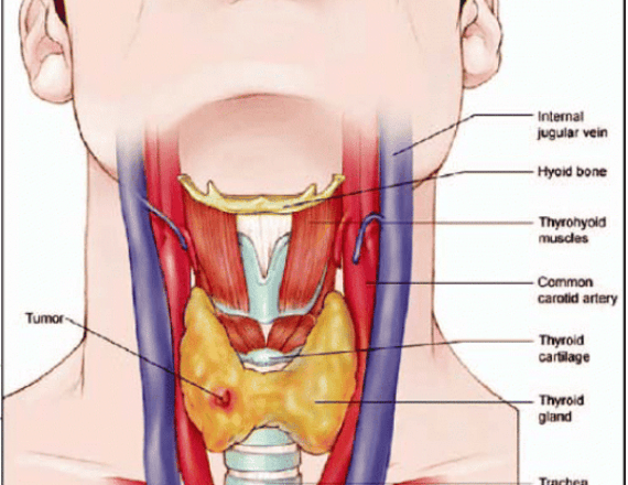 YOGA FOR THYROID-min